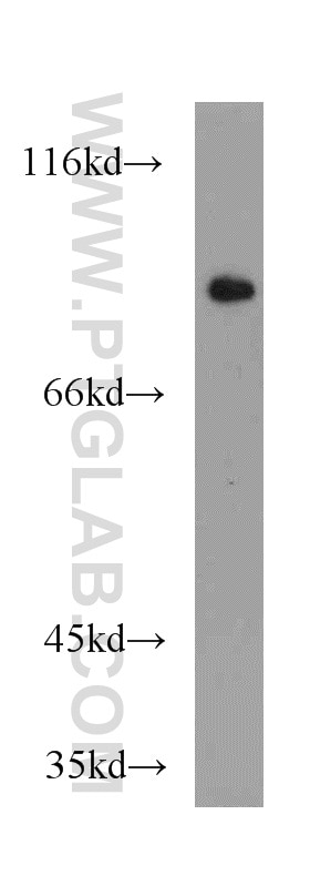 Western Blot (WB) analysis of mouse kidney tissue using PEX5 Polyclonal antibody (12545-1-AP)