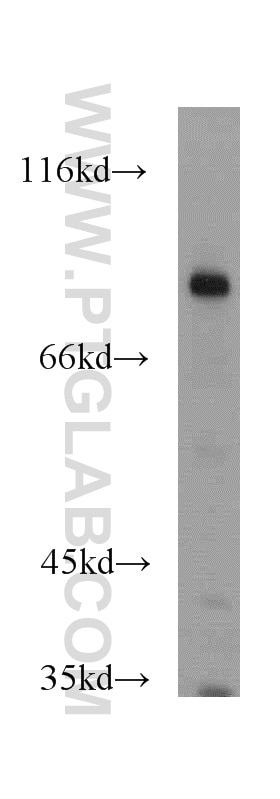 Western Blot (WB) analysis of mouse brain tissue using PEX5 Polyclonal antibody (12545-1-AP)