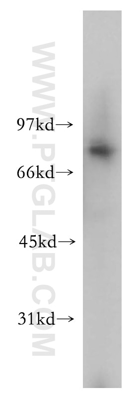 Western Blot (WB) analysis of human kidney tissue using PEX5 Polyclonal antibody (12545-1-AP)