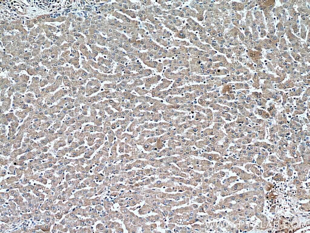Immunohistochemistry (IHC) staining of human liver tissue using PEX5 Monoclonal antibody (66309-1-Ig)