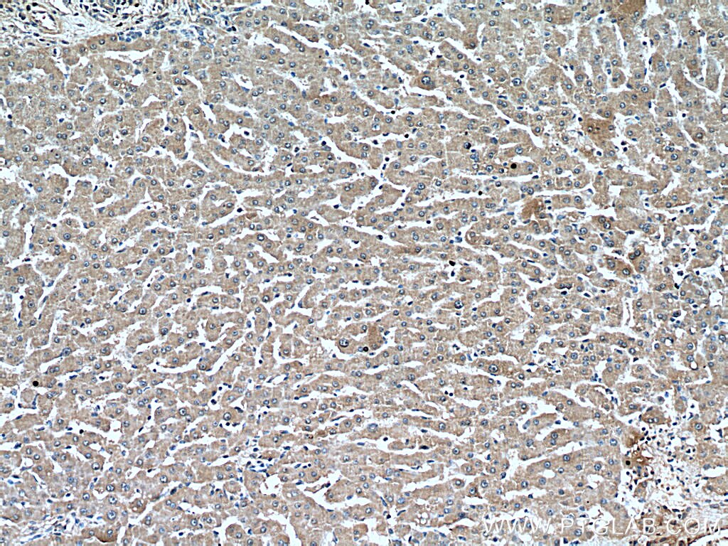 Immunohistochemistry (IHC) staining of human liver tissue using PEX5 Monoclonal antibody (66309-1-Ig)