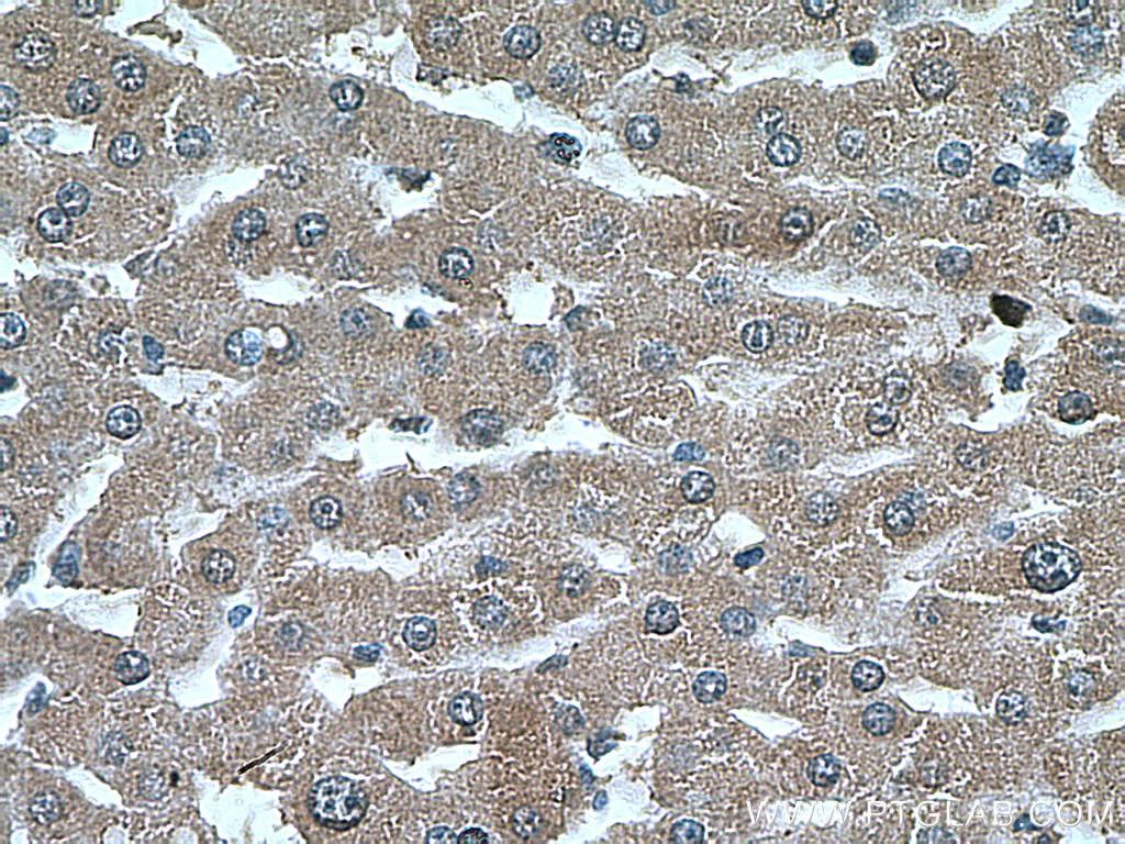 Immunohistochemistry (IHC) staining of human liver tissue using PEX5 Monoclonal antibody (66309-1-Ig)