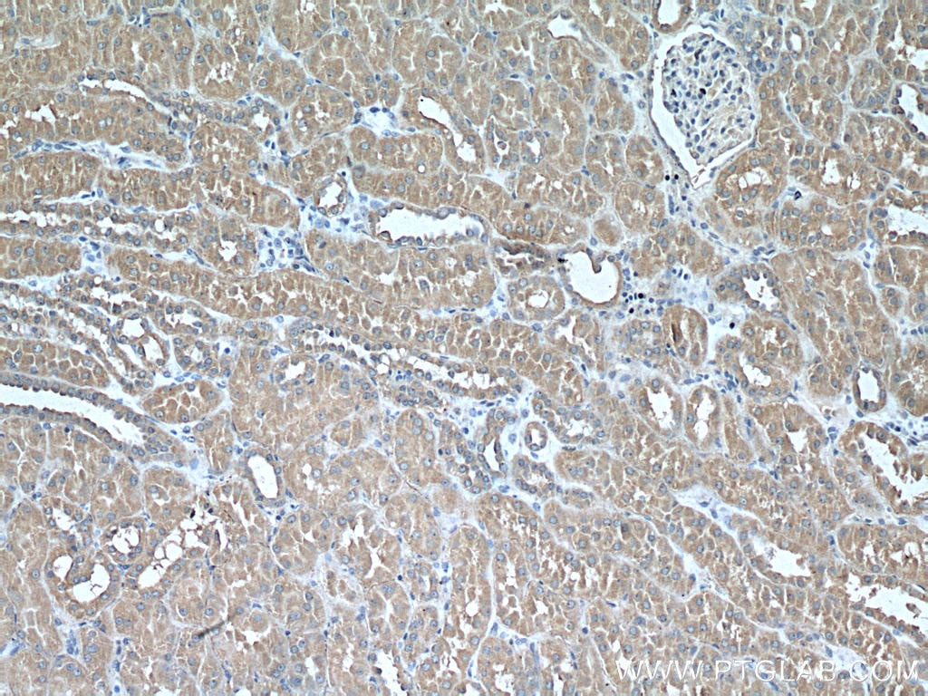 Immunohistochemistry (IHC) staining of human kidney tissue using PEX5 Monoclonal antibody (66309-1-Ig)