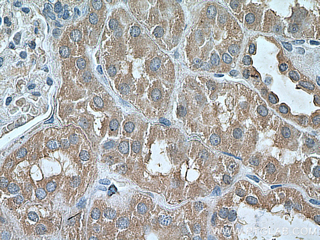 Immunohistochemistry (IHC) staining of human kidney tissue using PEX5 Monoclonal antibody (66309-1-Ig)