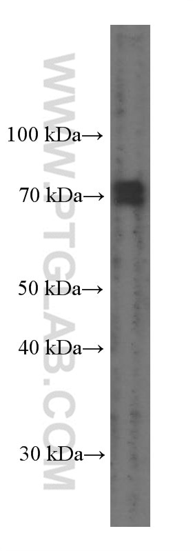 Western Blot (WB) analysis of fetal human brain tissue using PEX5 Monoclonal antibody (66309-1-Ig)