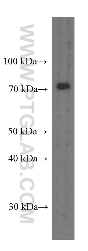 Western Blot (WB) analysis of pig brain tissue using PEX5 Monoclonal antibody (66309-1-Ig)