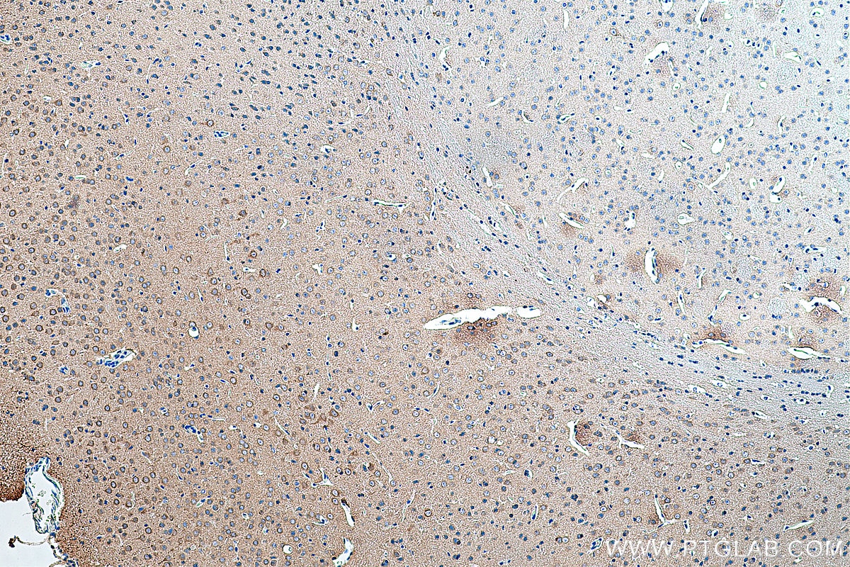 Immunohistochemistry (IHC) staining of mouse brain tissue using PEX5L Polyclonal antibody (13084-1-AP)