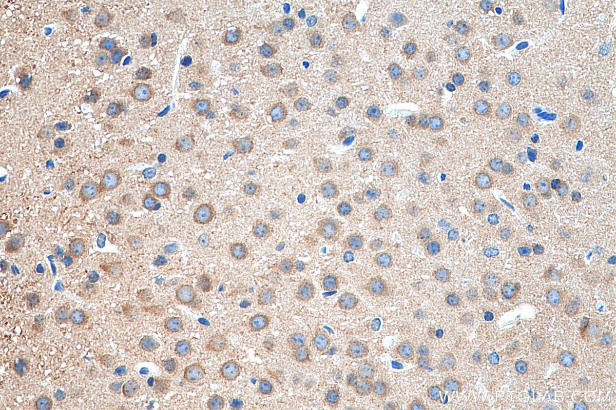 Immunohistochemistry (IHC) staining of mouse brain tissue using PEX5L Polyclonal antibody (13084-1-AP)