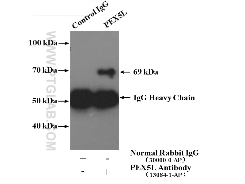 Immunoprecipitation (IP) experiment of mouse brain tissue using PEX5L Polyclonal antibody (13084-1-AP)