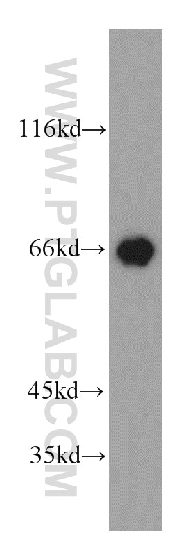 Western Blot (WB) analysis of mouse brain tissue using PEX5L Polyclonal antibody (13084-1-AP)