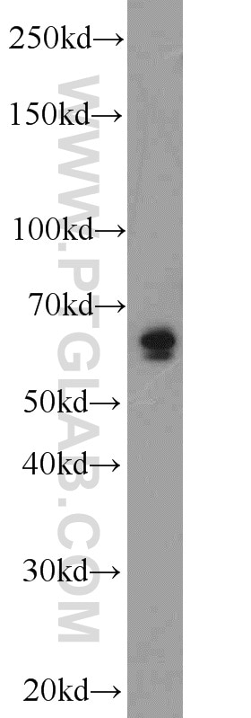 Western Blot (WB) analysis of mouse brain tissue using PEX5L Polyclonal antibody (13084-1-AP)