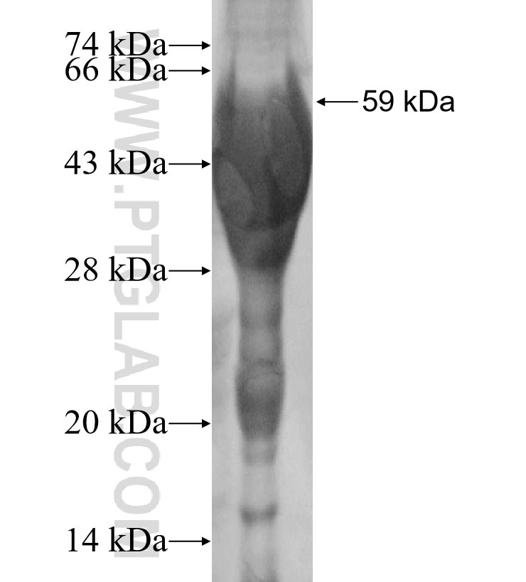 PEX5L fusion protein Ag3749 SDS-PAGE