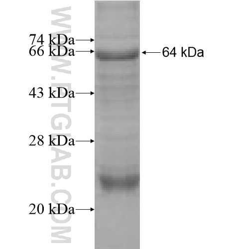 PEX6 fusion protein Ag11246 SDS-PAGE