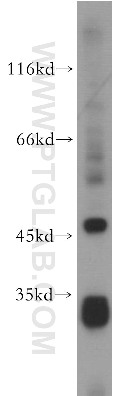 Western Blot (WB) analysis of MDA-MB-453s cells using PEX7 Polyclonal antibody (20614-1-AP)