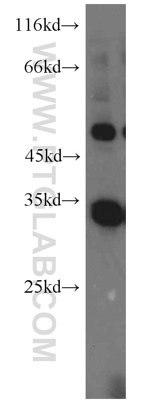 Western Blot (WB) analysis of MDA-MB-453s cells using PEX7 Polyclonal antibody (20614-1-AP)