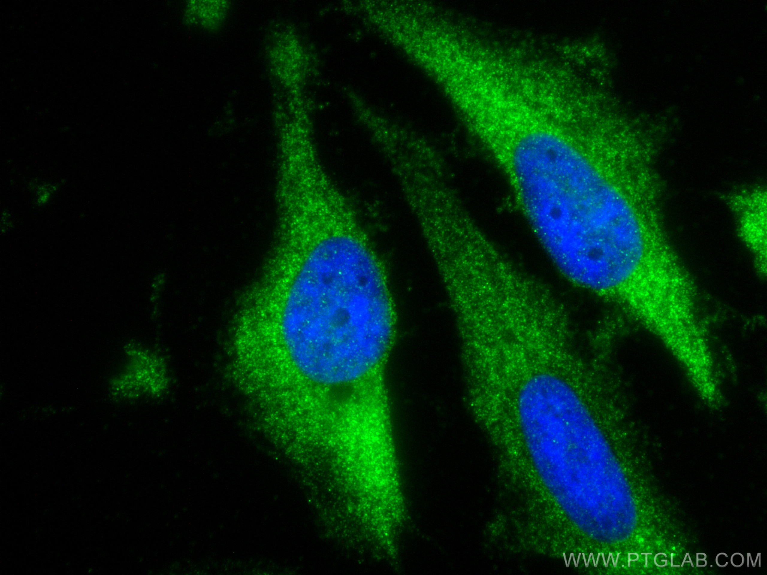 Immunofluorescence (IF) / fluorescent staining of HeLa cells using PF4 Polyclonal antibody (21157-1-AP)