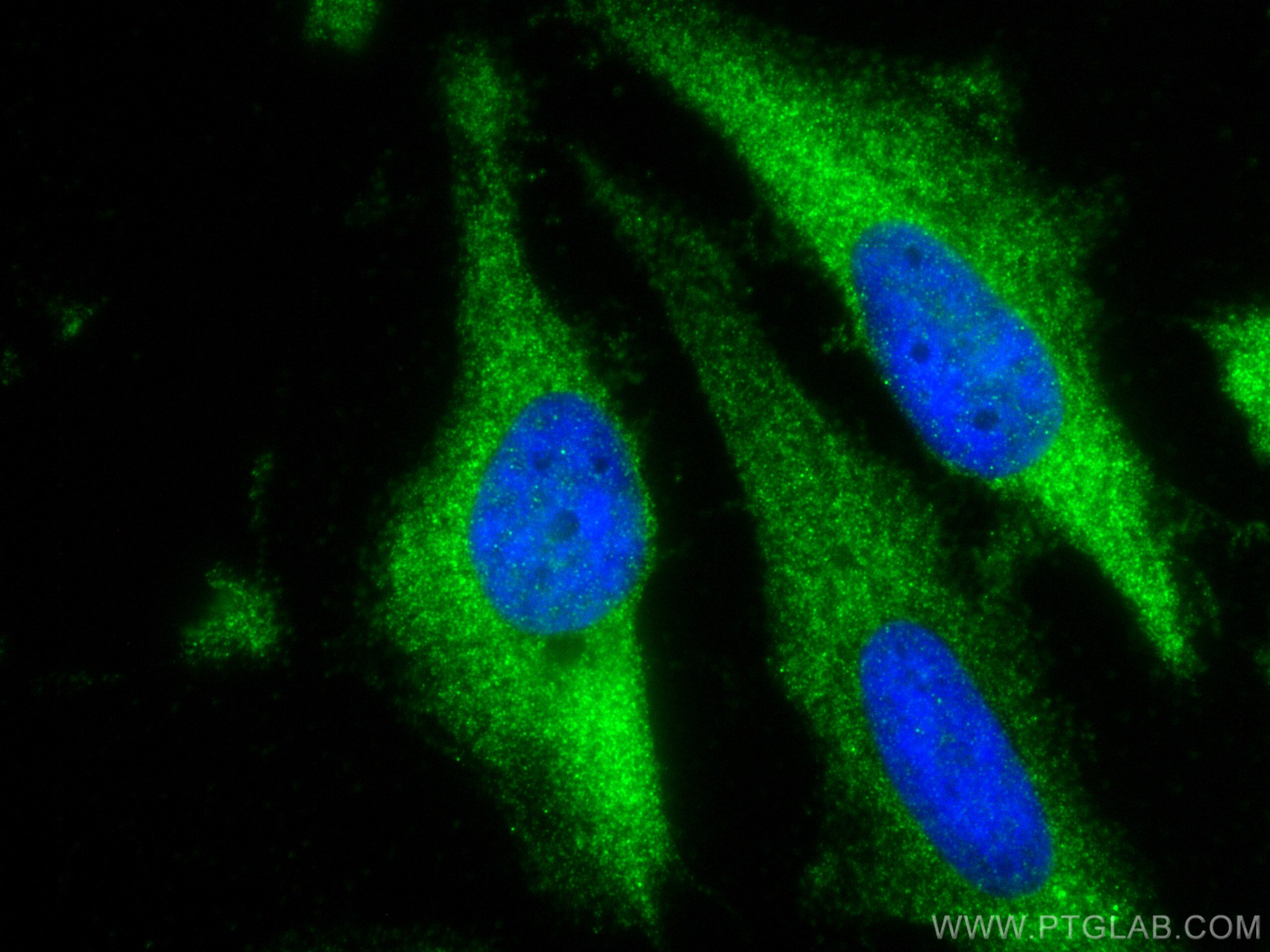 Immunofluorescence (IF) / fluorescent staining of HeLa cells using CXCL4/PF4 Polyclonal antibody (21157-1-AP)