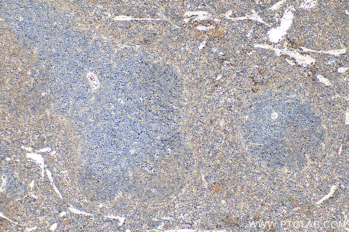 Immunohistochemistry (IHC) staining of mouse spleen tissue using PF4 Polyclonal antibody (21157-1-AP)