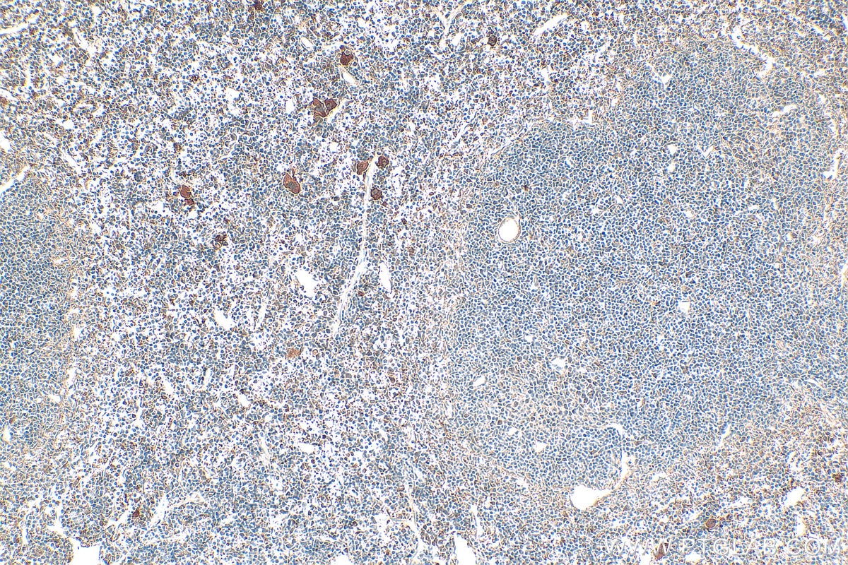 Immunohistochemistry (IHC) staining of mouse spleen tissue using CXCL4/PF4 Polyclonal antibody (21157-1-AP)