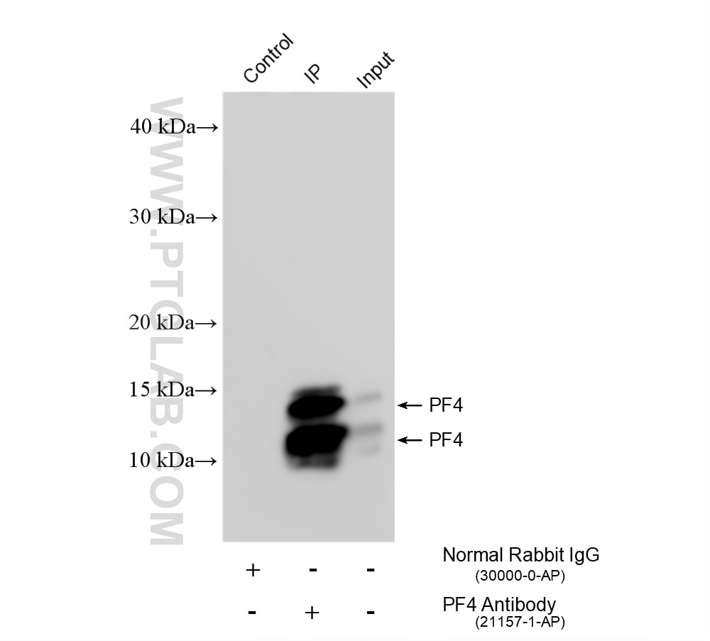 Immunoprecipitation (IP) experiment of mouse serum using CXCL4/PF4 Polyclonal antibody (21157-1-AP)