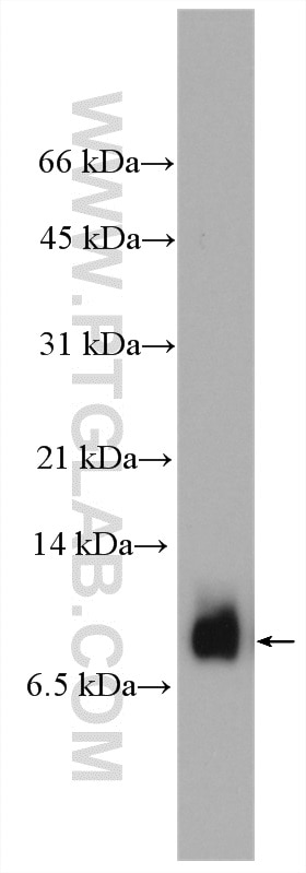 Western Blot (WB) analysis of mouse spleen tissue using PF4 Polyclonal antibody (21157-1-AP)