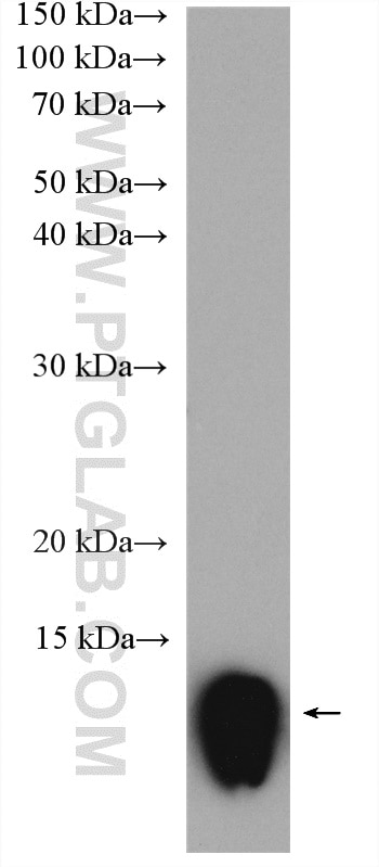 Western Blot (WB) analysis of human peripheral blood platelets using PF4 Polyclonal antibody (21157-1-AP)