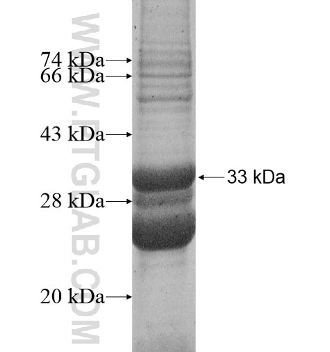 PF4 fusion protein Ag12345 SDS-PAGE