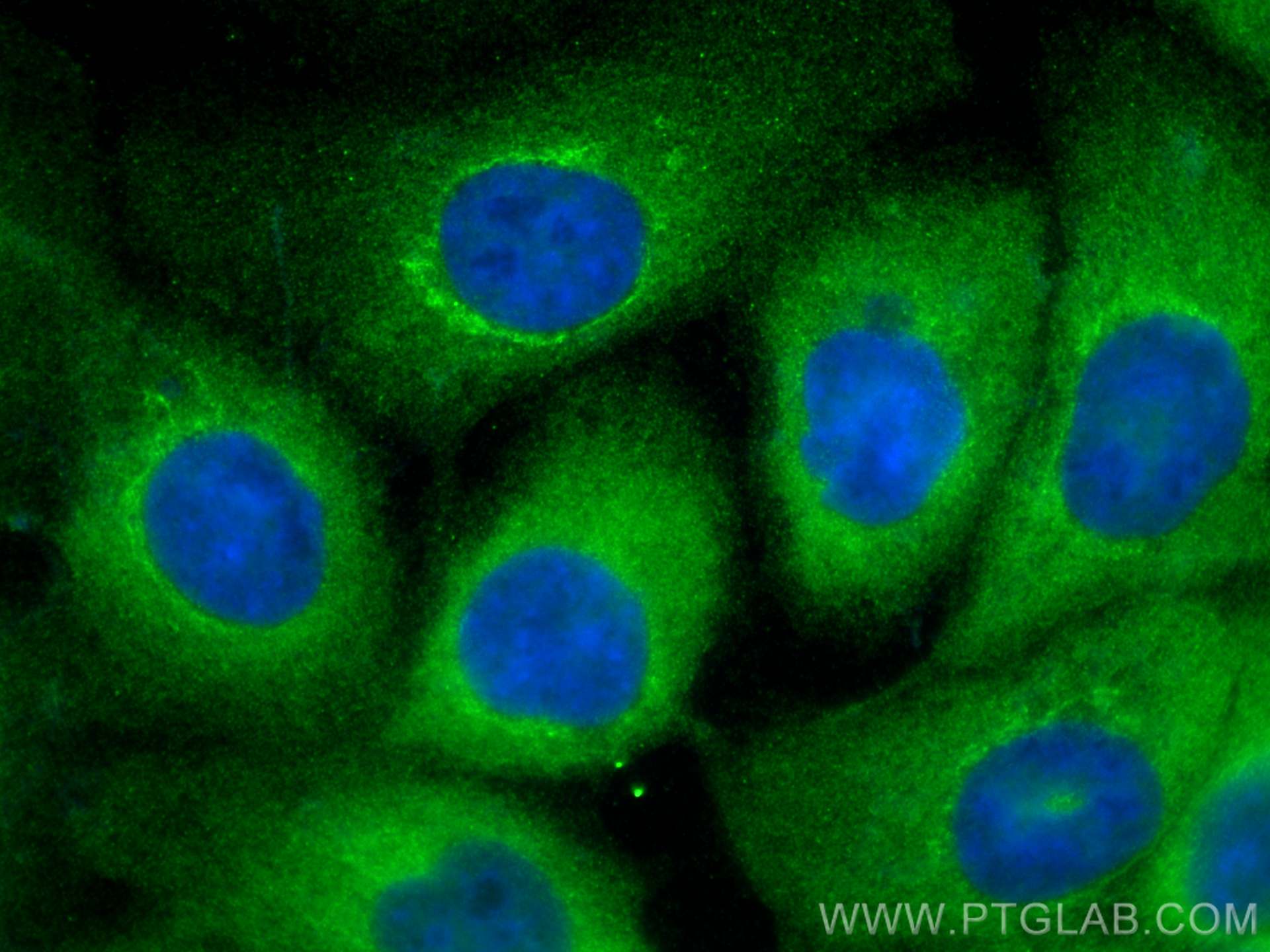 Immunofluorescence (IF) / fluorescent staining of A431 cells using PFAS Polyclonal antibody (24716-1-AP)