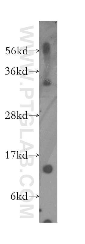 Western Blot (WB) analysis of human colon tissue using PFDN1 Polyclonal antibody (11033-2-AP)