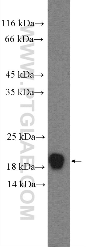 Western Blot (WB) analysis of Neuro-2a cells using PFDN2 Polyclonal antibody (13053-1-AP)