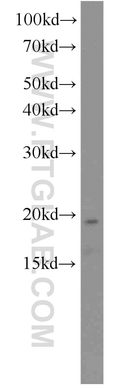 Western Blot (WB) analysis of L02 cells using PFDN2 Polyclonal antibody (13053-1-AP)