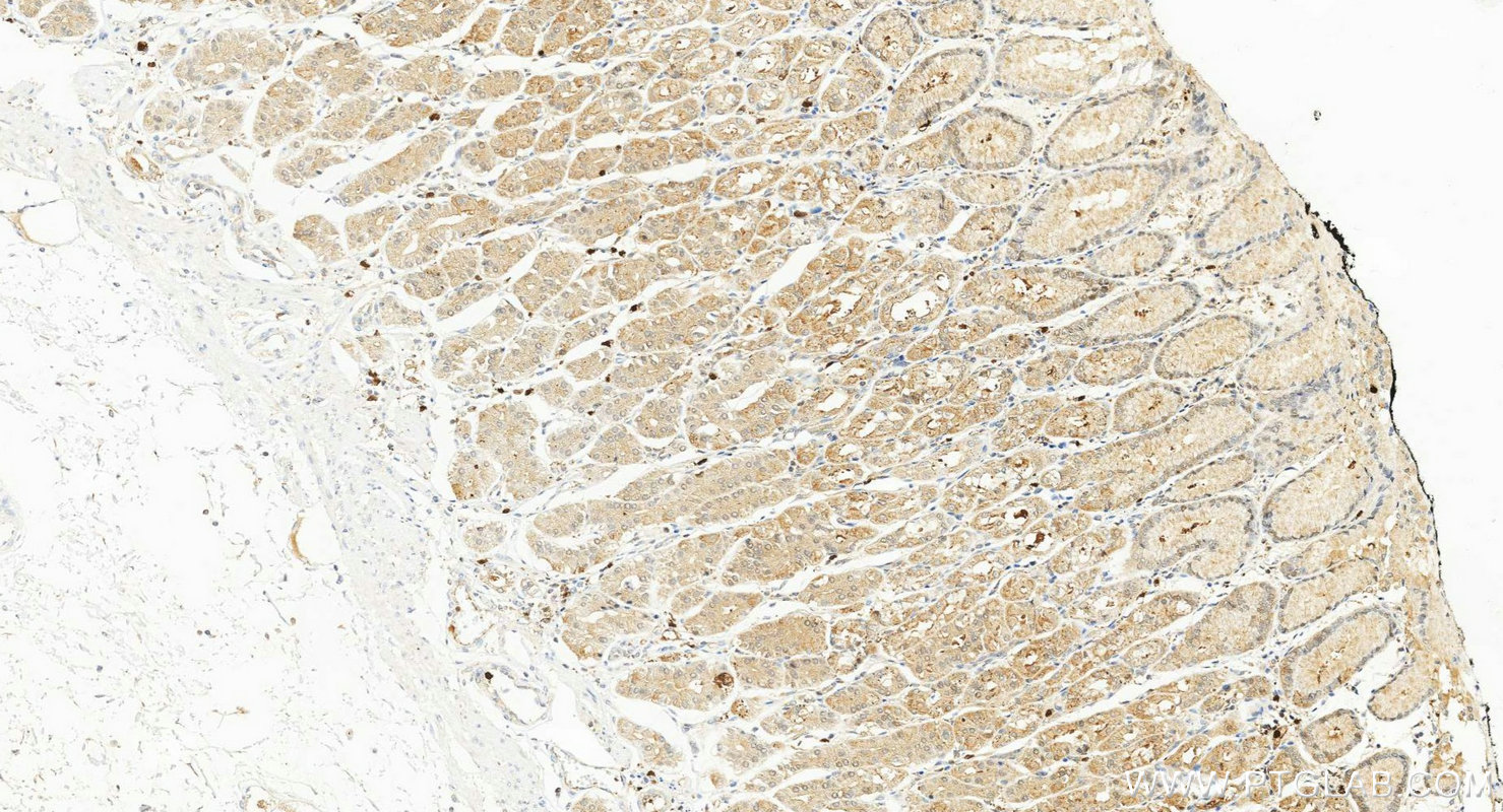 IHC staining of human stomach using 15078-1-AP (same clone as 15078-1-PBS) Immunohistochemistry (IHC) staining of human stomach tissue using PFDN5 Polyclonal antibody (15078-1-AP)