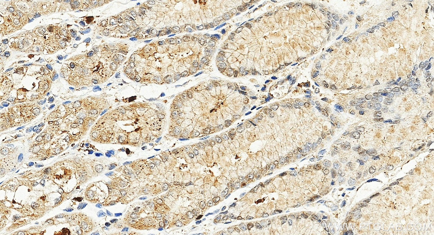IHC staining of human stomach using 15078-1-AP (same clone as 15078-1-PBS) Immunohistochemistry (IHC) staining of human stomach tissue using PFDN5 Polyclonal antibody (15078-1-AP)