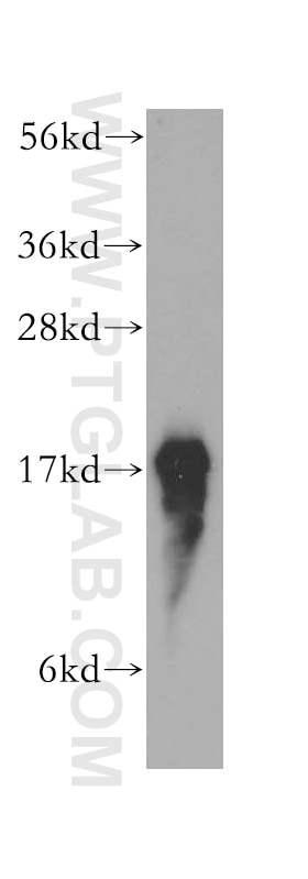 Western Blot (WB) analysis of PC-3 cells using PFDN5 Polyclonal antibody (15078-1-AP)