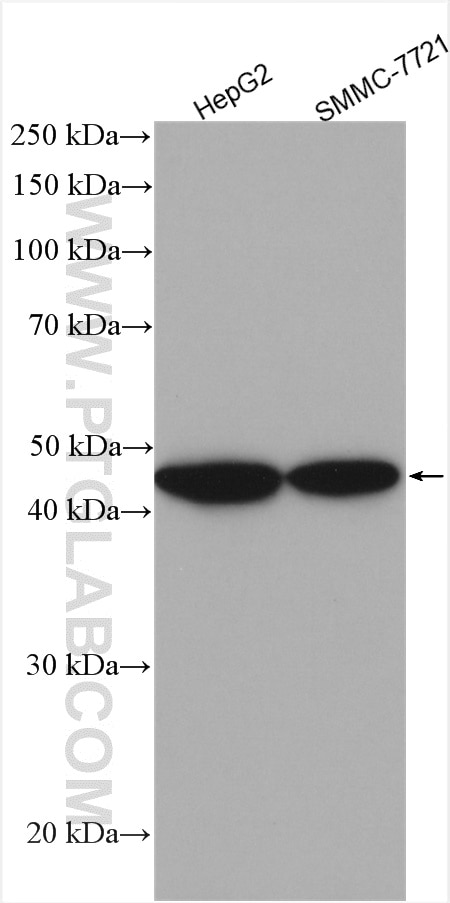 Western Blot (WB) analysis of various lysates using PFKFB1 Polyclonal antibody (21718-1-AP)