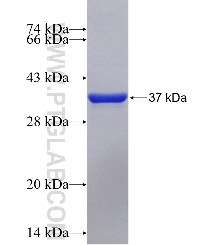 PFKFB1 fusion protein Ag16362 SDS-PAGE