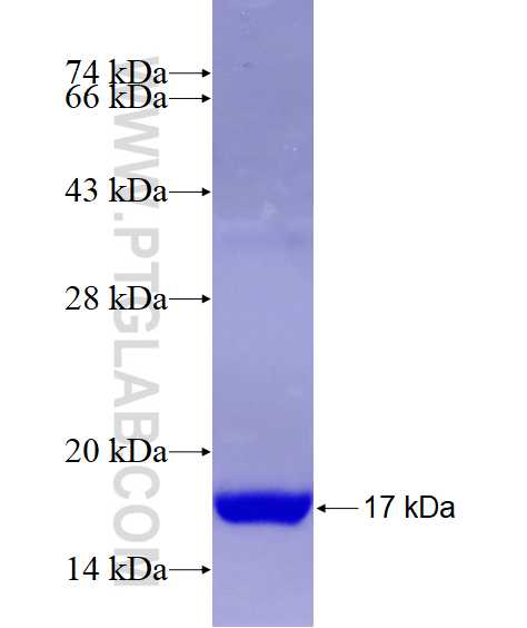 PFKFB1 fusion protein Ag16752 SDS-PAGE