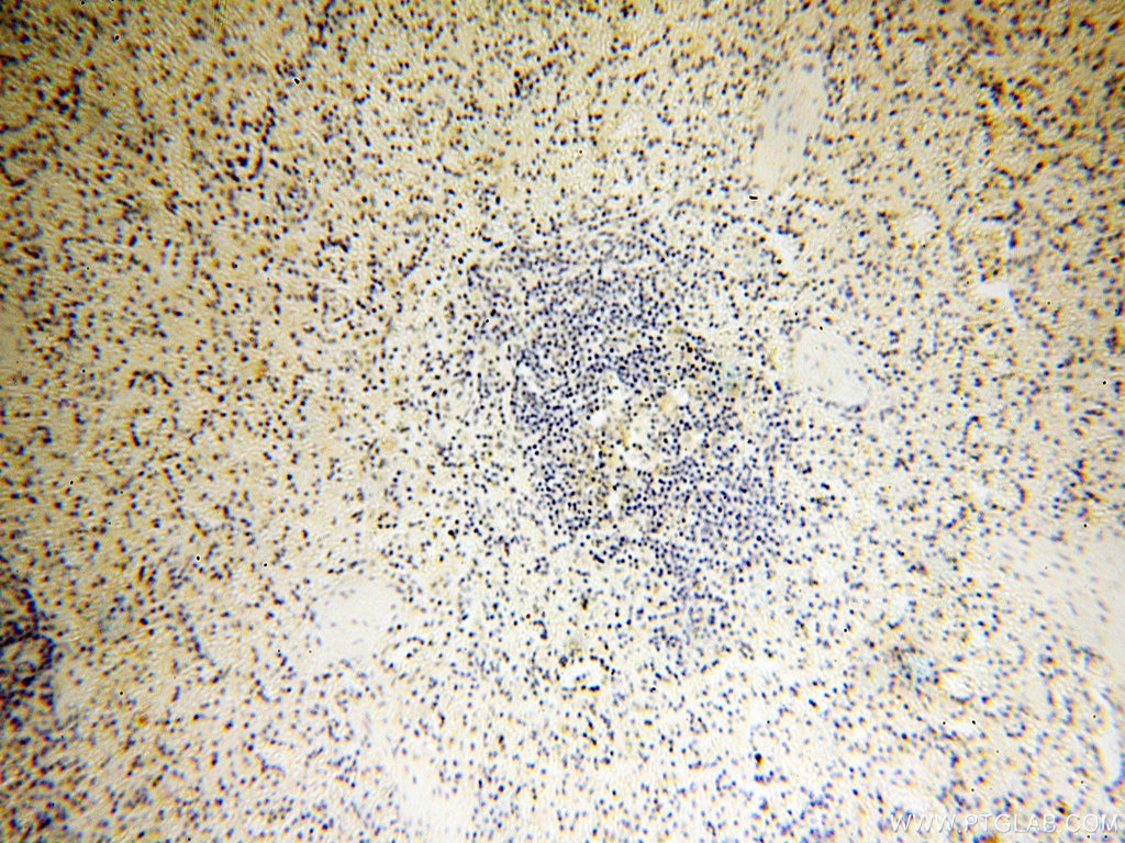 IHC staining of human spleen using 17838-1-AP