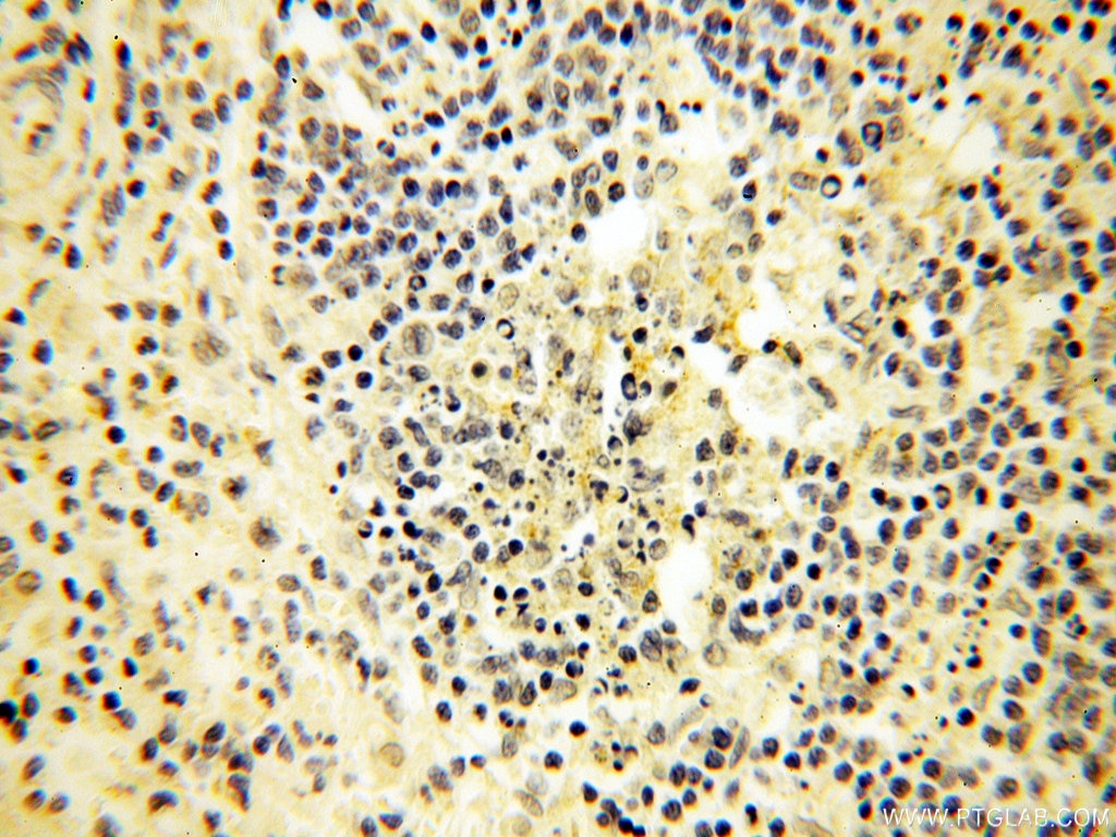 IHC staining of human spleen using 17838-1-AP