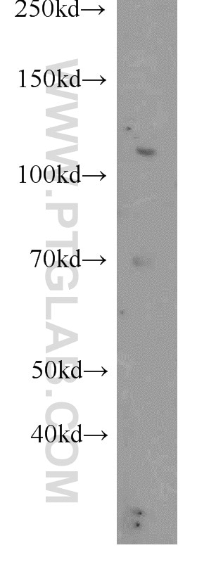 Western Blot (WB) analysis of rat brain tissue using PFKFB2 Polyclonal antibody (17838-1-AP)