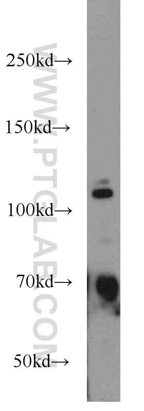 Western Blot (WB) analysis of mouse brain tissue using PFKFB2 Polyclonal antibody (17838-1-AP)