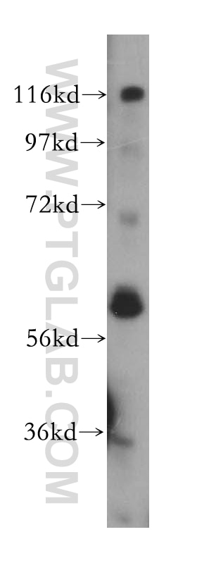 Western Blot (WB) analysis of human heart tissue using PFKFB2 Polyclonal antibody (17838-1-AP)