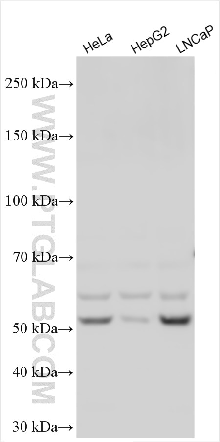 Western Blot (WB) analysis of various lysates using PFKFB2 Polyclonal antibody (30425-1-AP)