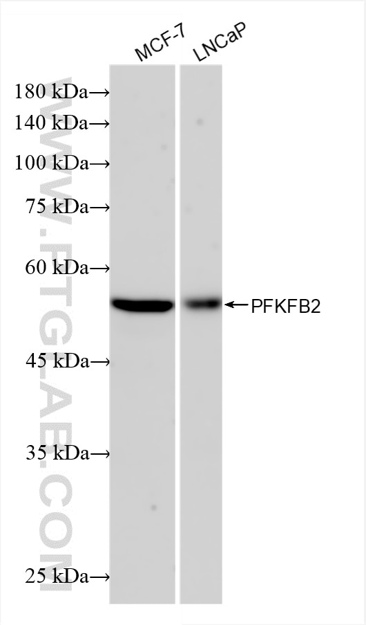 Western Blot (WB) analysis of various lysates using PFKFB2 Recombinant antibody (85639-6-RR)