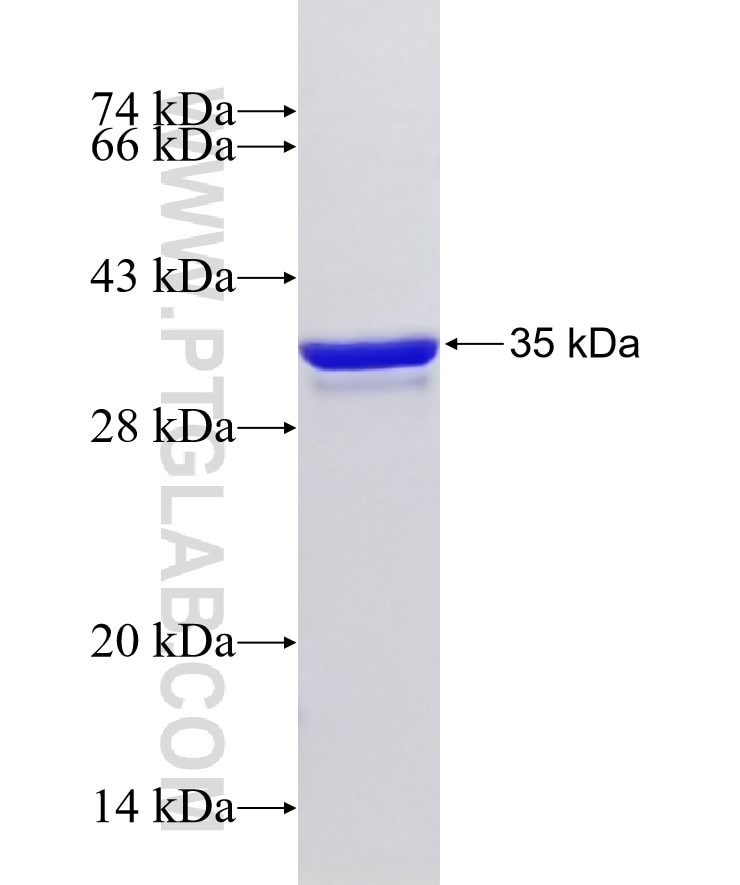 PFKFB2 fusion protein Ag32347 SDS-PAGE