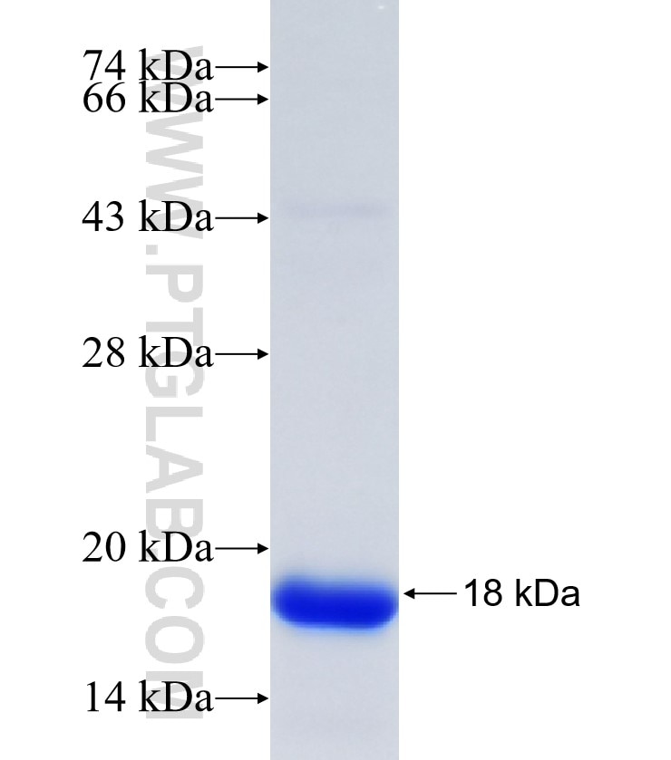 PFKFB2 fusion protein Ag35229 SDS-PAGE