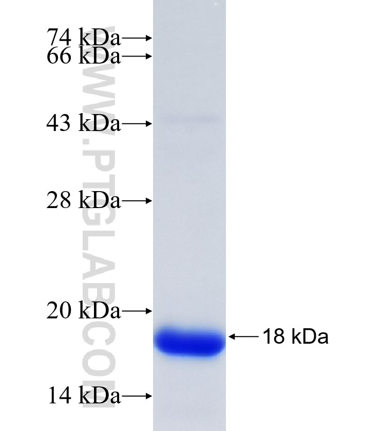 PFKFB2 fusion protein Ag35229 SDS-PAGE PFKFB2 fusion protein Ag35229 SDS-PAGE