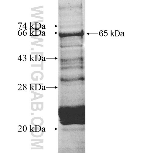 PFKFB2 fusion protein Ag12181 SDS-PAGE