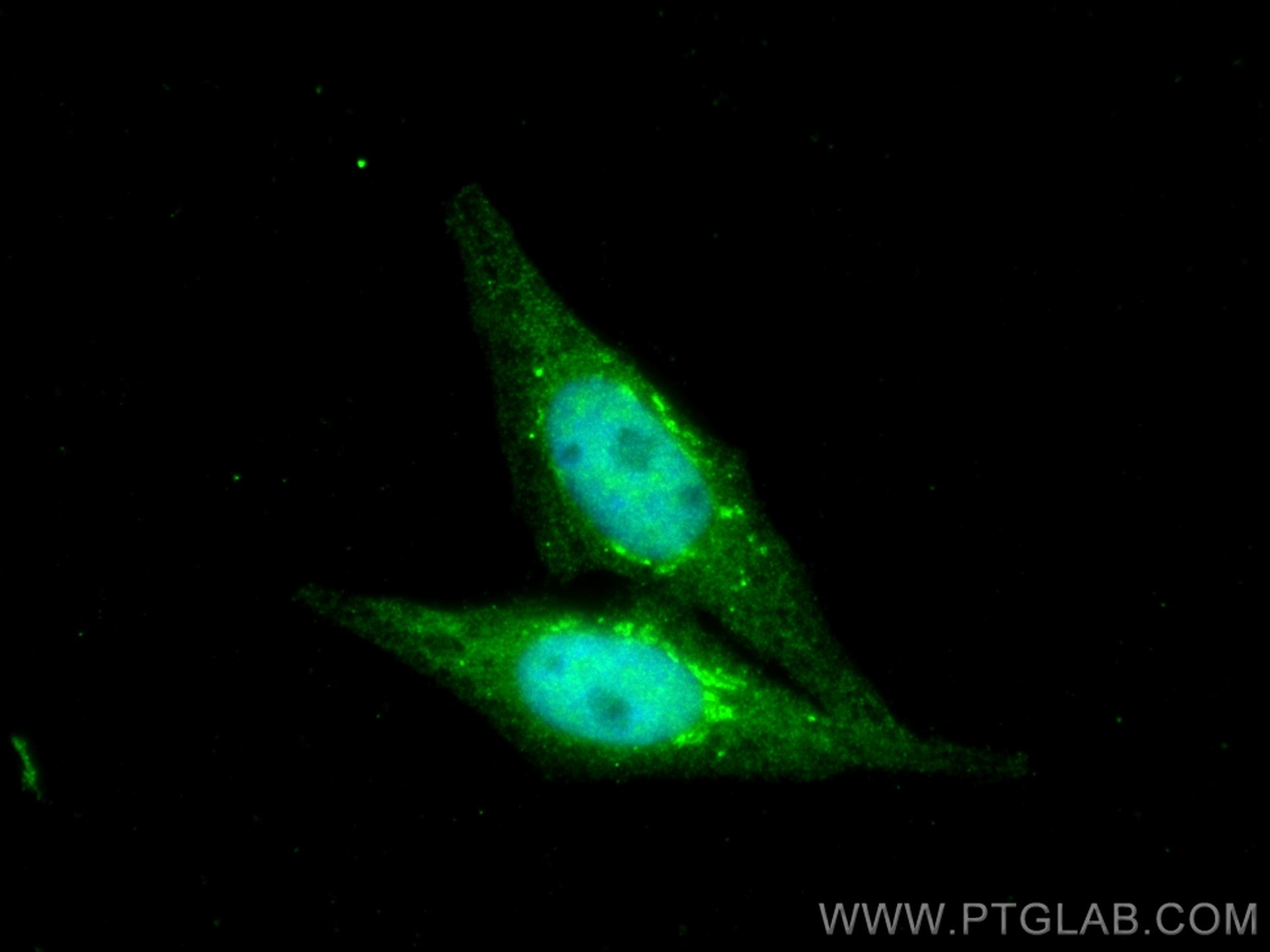 Immunofluorescence (IF) / fluorescent staining of HepG2 cells using PFKFB3 Polyclonal antibody (13763-1-AP)
