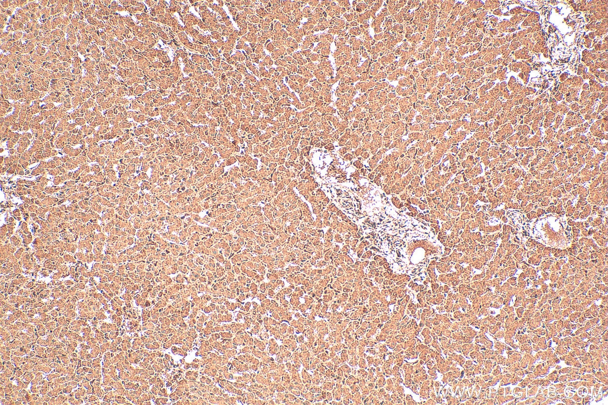 Immunohistochemistry (IHC) staining of human liver tissue using PFKFB3 Polyclonal antibody (13763-1-AP)